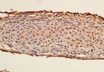 Phospho-PDGFRA (Tyr762) Rabbit Polyclonal Antibody